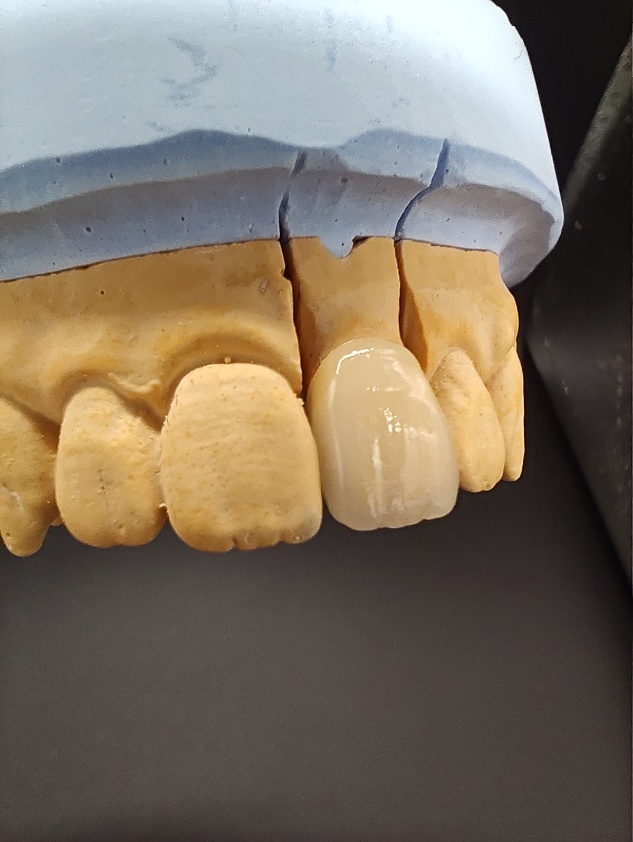 Ｒ７ 山田和伸先生ポーセレンセミナー（技工士科）